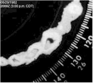 Closeup of tornadic superell from St. Louis radar image from 05/29/1982 at 3:00 p.m. CDT